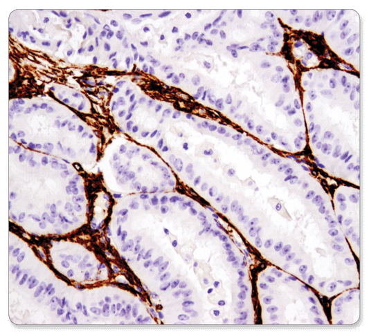 Immunohistochemistry-IHC-19245-a-Smooth Muscle Actin.png